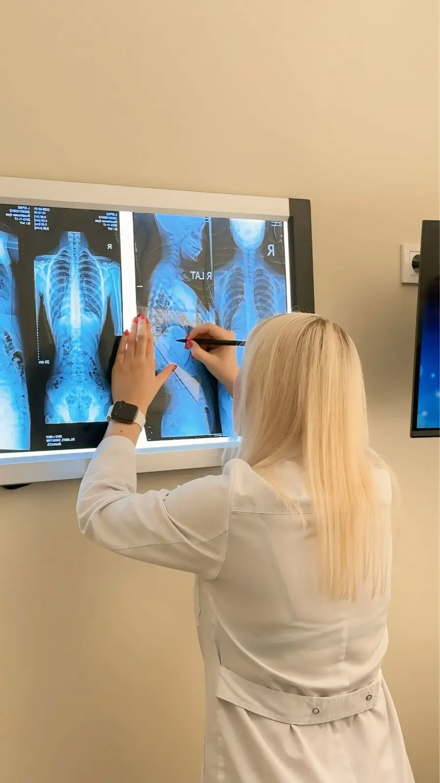 Ортотис - Центральная Азия